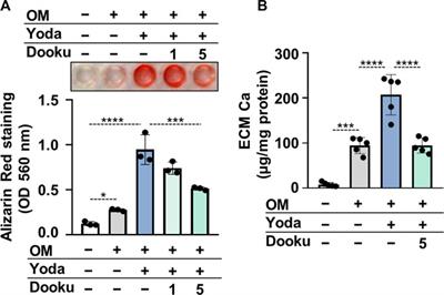 The mechanosensitive Piezo1 channels contribute to the arterial medial calcification